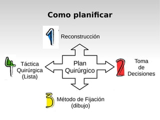 Como planificar
Plan
Quirúrgico
Reconstrucción
Toma
de
Decisiones
Método de Fijación
(dibujo)
Táctica
Quirúrgica
(Lista)
 