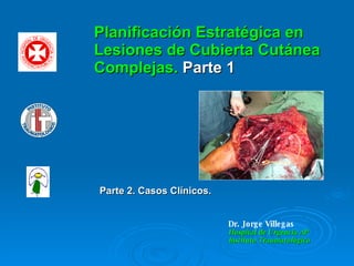 Dr. Jorge Villegas  Hospital de Urgencia AP Instituto Traumatológico   Planificación Estratégica en Lesiones de Cubierta Cutánea Complejas.  Parte 1 Parte 2. Casos Clínicos. 