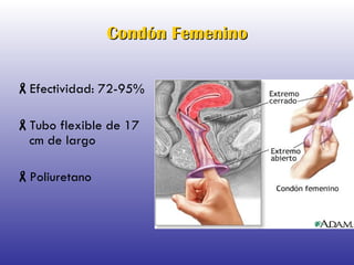 Condón Femenino Efectividad: 72-95% Tubo flexible de 17 cm de largo Poliuretano 