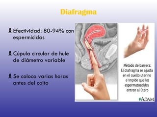 Diafragma Efectividad: 80-94% con espermicidas Cúpula circular de hule de diámetro variable Se coloca varias horas antes del coito 