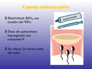 Esponja anticonceptiva Efectividad: 80%, con condón del 98% Disco de poliuretano impregnado con nonoxinol-9 Se coloca 24 horas antes del coito espermicida 