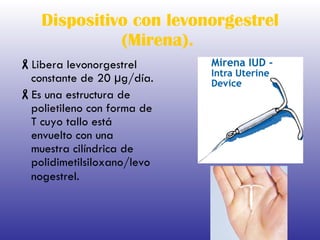 Dispositivo con levonorgestrel (Mirena).   Libera levonorgestrel constante de 20 µg/día. Es una estructura de polietileno con forma de T cuyo tallo está envuelto con una muestra cilíndrica de polidimetilsiloxano/levonogestrel.   