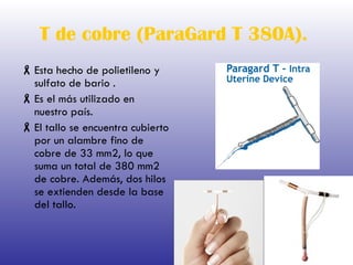 T de cobre (ParaGard T 380A).   Esta hecho de polietileno y sulfato de bario   . Es el más utilizado en nuestro país. El tallo se encuentra cubierto por un alambre fino de cobre de 33 mm2, lo que suma un total de 380 mm2 de cobre. Además, dos hilos se extienden desde la base del tallo. 
