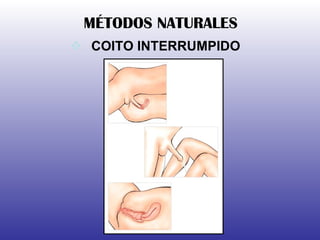COITO INTERRUMPIDO MÉTODOS NATURALES 