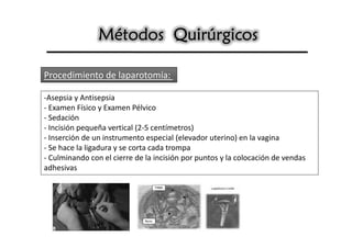 Métodos Quirúrgicos

Procedimiento de laparotomía:

-Asepsia y Antisepsia
- Examen Físico y Examen Pélvico
- Sedación
- Incisión pequeña vertical (2-5 centímetros)
- Inserción de un instrumento especial (elevador uterino) en la vagina
- Se hace la ligadura y se corta cada trompa
- Culminando con el cierre de la incisión por puntos y la colocación de vendas
adhesivas
 