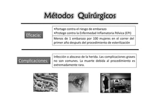 Métodos Quirúrgicos
                  •Portage contra el riesgo de embarazo
                  •Protege contra la Enfermedad Inflamatoria Pélvica (EPI)
   Eficacia:
                  Menos de 1 embarazo por 100 mujeres en el correr del
                  primer año después del procedimiento de esterilización



                  Infección o absceso de la herida. Las complicaciones graves
Complicaciones:   no son comunes. La muerte debida al procedimiento es
                  extremadamente rara.
 