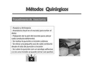 Métodos Quirúrgicos

 Procedimiento de Vasectomía:


- Asepsia y Antisepsia
- Anestésico local en el escroto para evitar el
dolor.
- Palpación de la piel del escroto para ubicar
cada conducto deferentes
- Se realiza la punción o incisión cutánea
- Se eleva una pequeña asa de cada conducto
desde el sitio de punción o incisión
- Se cubre la punción con un vendaje adhesivo
y si es una incisión se puede cerrar con puntos
 