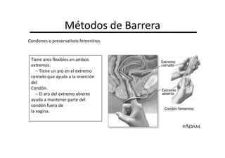Métodos de Barrera
Condones o preservativos femeninos


 Tiene aros flexibles en ambos
 extremos.
    – Tiene un aro en el extremo
 cerrado que ayuda a la inserción
 del
 Condón.
    – El aro del extremo abierto
 ayuda a mantener parte del
 condón fuera de
 la vagina.
 