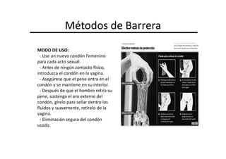 Métodos de Barrera
MODO DE USO:
  - Use un nuevo condón Femenino
para cada acto sexual.
  - Antes de ningún contacto físico,
introduzca el condón en la vagina.
  - Asegúrese que el pene entra en el
condón y se mantiene en su interior.
  - Después de que el hombre retira su
pene, sostenga el aro externo del
condón, gírelo para sellar dentro los
fluidos y suavemente, retírelo de la
vagina.
  - Eliminación segura del condón
usado.
 