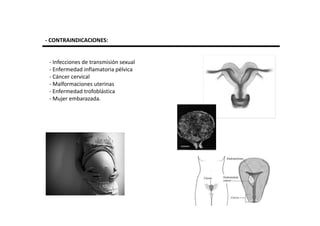 - CONTRAINDICACIONES:


 - Infecciones de transmisión sexual
 - Enfermedad inflamatoria pélvica
 - Cáncer cervical
 - Malformaciones uterinas
 - Enfermedad trofoblástica
 - Mujer embarazada.
 