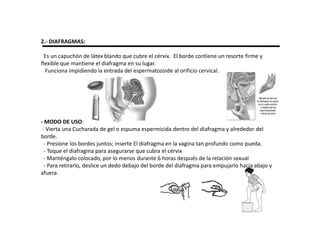 2.- DIAFRAGMAS:

  Es un capuchón de látex blando que cubre el cérvix. El borde contiene un resorte firme y
flexible que mantiene el diafragma en su lugar.
  Funciona impidiendo la entrada del espermatozoide al orificio cervical.




- MODO DE USO:
 - Vierta una Cucharada de gel o espuma espermicida dentro del diafragma y alrededor del
borde.
  - Presione los bordes juntos; inserte El diafragma en la vagina tan profundo como pueda.
  - Toque el diafragma para asegurarse que cubra el cérvix
  - Manténgalo colocado, por lo menos durante 6 horas después de la relación sexual
  - Para retirarlo, deslice un dedo debajo del borde del diafragma para empujarlo hacia abajo y
afuera.
 