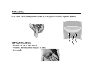 - INDICACIONES:

- Casi todas las mujeres pueden utilizar el diafragma de manera segura y efectiva.




- CONTRAINDICACIONES:
  - Después del parto o un aborto.
  - Presencia de reacciones alérgicas al látex.
  - Histerocele.
 