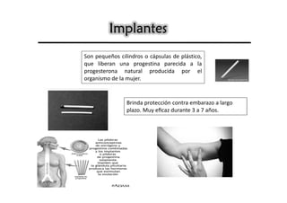 Implantes
Son pequeños cilindros o cápsulas de plástico,
que liberan una progestina parecida a la
progesterona natural producida por el
organismo de la mujer.


                Brinda protección contra embarazo a largo
                plazo. Muy eﬁcaz durante 3 a 7 años.
 