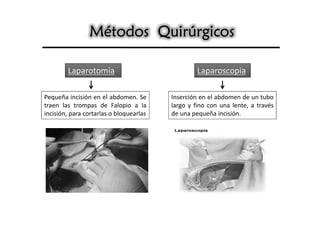 Métodos Quirúrgicos

        Laparotomía                               Laparoscopia

Pequeña incisión en el abdomen. Se       Inserción en el abdomen de un tubo
traen las trompas de Falopio a la        largo y fino con una lente, a través
incisión, para cortarlas o bloquearlas   de una pequeña incisión.
 