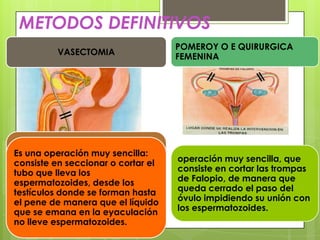 METODOS DEFINITIVOS
                                    POMEROY O E QUIRURGICA
         VASECTOMIA
                                    FEMENINA




Es una operación muy sencilla:
consiste en seccionar o cortar el   operación muy sencilla, que
tubo que lleva los                  consiste en cortar las trompas
espermatozoides, desde los          de Falopio, de manera que
testículos donde se forman hasta    queda cerrado el paso del
el pene de manera que el líquido    óvulo impidiendo su unión con
que se emana en la eyaculación      los espermatozoides.
no lleve espermatozoides.
 