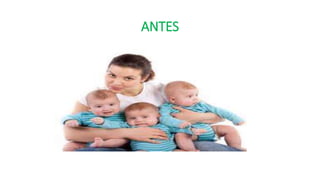 ANTES
 