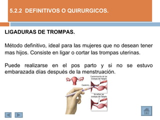 5.2.2 DEFINITIVOS O QUIRURGICOS.


LIGADURAS DE TROMPAS.

Método definitivo, ideal para las mujeres que no desean tener
mas hijos. Consiste en ligar o cortar las trompas uterinas.

Puede realizarse en el pos parto y si no se estuvo
embarazada días después de la menstruación.
 