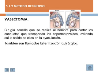 5.1.2 METODO DEFINITIVO.


VASECTOMIA.

Cirugía sencilla que se realiza al hombre para cortar los
conductos que transportan los espermatozoides, evitando
así la salida de ellos en la eyaculación.
También son llamados Esterilización quirúrgica.
 