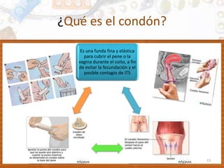 ¿Qué es el condón?
13
Es una funda fina y elástica
para cubrir el pene o la
vagina durante el coito, a fin
de evitar la fecundación y el
posible contagio de ITS
 