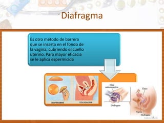 Diafragma
Es otro método de barrera
que se inserta en el fondo de
la vagina, cubriendo el cuello
uterino. Para mayor eficacia
se le aplica espermicida
14
 