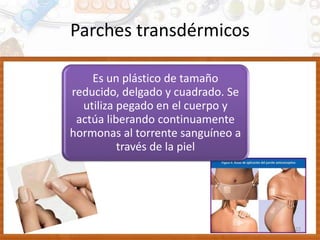 Parches transdérmicos
22
Es un plástico de tamaño
reducido, delgado y cuadrado. Se
utiliza pegado en el cuerpo y
actúa liberando continuamente
hormonas al torrente sanguíneo a
través de la piel
 