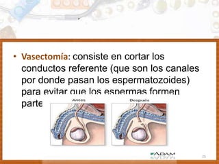 • Vasectomía: consiste en cortar los
conductos referente (que son los canales
por donde pasan los espermatozoides)
para evitar que los espermas formen
parte del semen.
25
 
