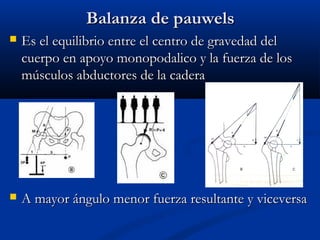 BBaallaannzzaa ddee ppaauuwweellss 
 EEss eell eeqquuiilliibbrriioo eennttrree eell cceennttrroo ddee ggrraavveeddaadd ddeell 
ccuueerrppoo eenn aappooyyoo mmoonnooppooddaalliiccoo yy llaa ffuueerrzzaa ddee llooss 
mmúússccuullooss aabbdduuccttoorreess ddee llaa ccaaddeerraa 
 AA mmaayyoorr áánngguulloo mmeennoorr ffuueerrzzaa rreessuullttaannttee yy vviicceevveerrssaa 
 