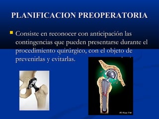 PPLLAANNIIFFIICCAACCIIOONN PPRREEOOPPEERRAATTOORRIIAA 
 CCoonnssiissttee eenn rreeccoonnoocceerr ccoonn aannttiicciippaacciióónn llaass 
ccoonnttiinnggeenncciiaass qquuee ppuueeddeenn pprreesseennttaarrssee dduurraannttee eell 
pprroocceeddiimmiieennttoo qquuiirrúúrrggiiccoo,, ccoonn eell oobbjjeettoo ddee 
pprreevveenniirrllaass yy eevviittaarrllaass.. 
 