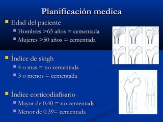 PPllaanniiffiiccaacciióónn mmeeddiiccaa 
 EEddaadd ddeell ppaacciieennttee 
 HHoommbbrreess >>6655 aaññooss == cceemmeennttaaddaa 
 MMuujjeerreess >>5500 aaññooss == cceemmeennttaaddaa 
 ÍÍnnddiiccee ddee ssiinngghh 
 44 oo mmaass == nnoo cceemmeennttaaddaa 
 33 oo mmeennooss == cceemmeennttaaddaa 
 ÍÍnnddiiccee ccoorrttiiccooddiiaaffiissaarriioo 
 MMaayyoorr ddee 00..4400 == nnoo cceemmeennttaaddaa 
 MMeennoorr ddee 00..3399== cceemmeennttaaddaa 
 