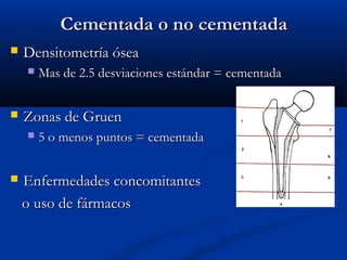 CCeemmeennttaaddaa oo nnoo cceemmeennttaaddaa 
 DDeennssiittoommeettrrííaa óósseeaa 
 MMaass ddee 22..55 ddeessvviiaacciioonneess eessttáánnddaarr == cceemmeennttaaddaa 
 ZZoonnaass ddee GGrruueenn 
 55 oo mmeennooss ppuunnttooss == cceemmeennttaaddaa 
 EEnnffeerrmmeeddaaddeess ccoonnccoommiittaanntteess 
oo uussoo ddee ffáárrmmaaccooss 
 