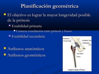 PPllaanniiffiiccaacciióónn ggeeoommééttrriiccaa 
 EEll oobbjjeettiivvoo eess llooggrraarr llaa mmaayyoorr lloonnggeevviiddaadd ppoossiibbllee 
ddee llaa pprróótteessiiss 
 EEssttaabbiilliiddaadd pprriimmaarriiaa 
 CCoorrrreeccttaa ccoonncciilliiaacciióónn eennttrree pprróótteessiiss yy hhuueessoo 
 EEssttaabbiilliiddaadd sseeccuunnddaarriiaa 
 AAttrriibbuuttooss aannaattóómmiiccooss 
 AAttrriibbuuttooss ggeeoommééttrriiccooss 
 