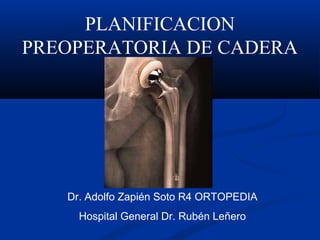 PLANIFICACION 
PREOPERATORIA DE CADERA 
Dr. Adolfo Zapién Soto R4 ORTOPEDIA 
Hospital General Dr. Rubén Leñero 
 