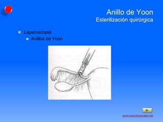 Planificación Quirúrgicos est