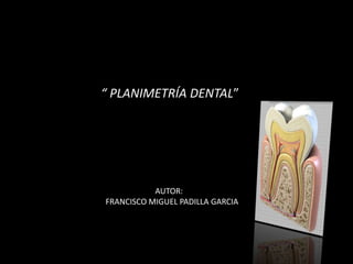 “ PLANIMETRÍA DENTAL” 
AUTOR: 
FRANCISCO MIGUEL PADILLA GARCIA 
 