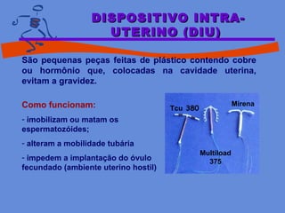 DISPOSITIVO INTRA-DISPOSITIVO INTRA-
UTERINO (DIU)UTERINO (DIU)
São pequenas peças feitas de plástico contendo cobre
ou hormônio que, colocadas na cavidade uterina,
evitam a gravidez.
Como funcionam:
- imobilizam ou matam os
espermatozóides;
- alteram a mobilidade tubária
- impedem a implantação do óvulo
fecundado (ambiente uterino hostil)
Tcu 380
Multiload
375
Mirena
 