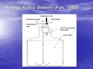 KarboyKarboy KKüültltüür Sistemi (r Sistemi (FoxFox, 1983)., 1983).
 