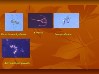 Bacteriastrum hyalinum
Ceratium
Protoperidinium
Asterionellopsis glacialis
 