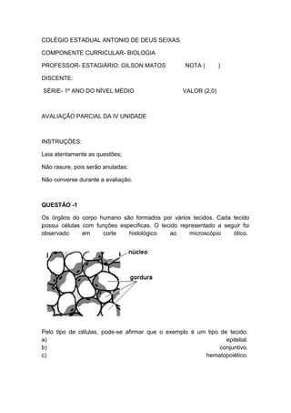 COLÉGIO ESTADUAL ANTONIO DE DEUS SEIXAS

COMPONENTE CURRICULAR- BIOLOGIA

PROFESSOR- ESTAGIÁRIO: GILSON MATOS                NOTA (       )

DISCENTE:

SÉRIE- 1º ANO DO NÍVEL MÉDIO                      VALOR (2,0)



AVALIAÇÃO PARCIAL DA IV UNIDADE



INSTRUÇÕES:

Leia atentamente as questões;

Não rasure, pois serão anuladas;

Não converse durante a avaliação.



QUESTÃO -1

Os órgãos do corpo humano são formados por vários tecidos. Cada tecido
possui células com funções específicas. O tecido representado a seguir foi
observado      em    corte    histológico    ao     microscópio    ótico.




Pelo tipo de células, pode-se afirmar que o exemplo é um tipo de tecido:
a)                                                              epitelial.
b)                                                            conjuntivo.
c)                                                      hematopoiético.
 