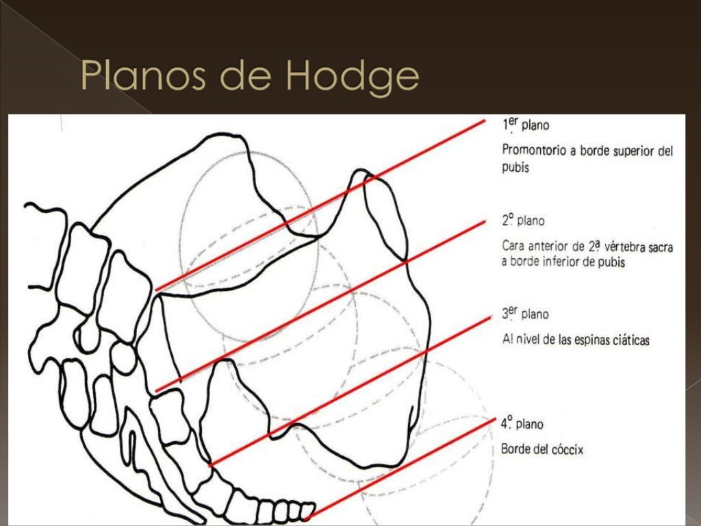 planos-de-hodge