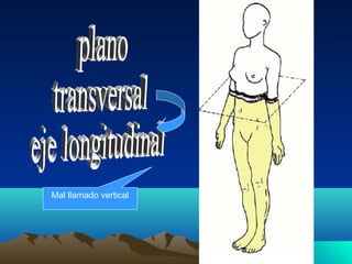 Mal llamado vertical
 