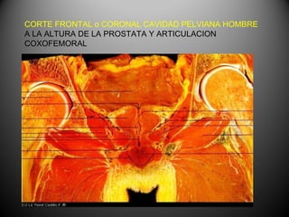 CORTE FRONTAL o CORONAL CAVIDAD PELVIANA HOMBRE
A LA ALTURA DE LA PROSTATA Y ARTICULACION
COXOFEMORAL
 