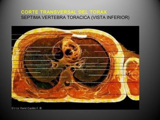 CORTE TRANSVERSAL DEL TORAX
SEPTIMA VERTEBRA TORACICA (VISTA INFERIOR)
 