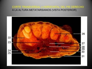 CORTE TRANSVERSAL o HORIZONTAL DEL PIE DERECHO
A LA ALTURA METATARSIANOS (VISTA POSTERIOR)
 