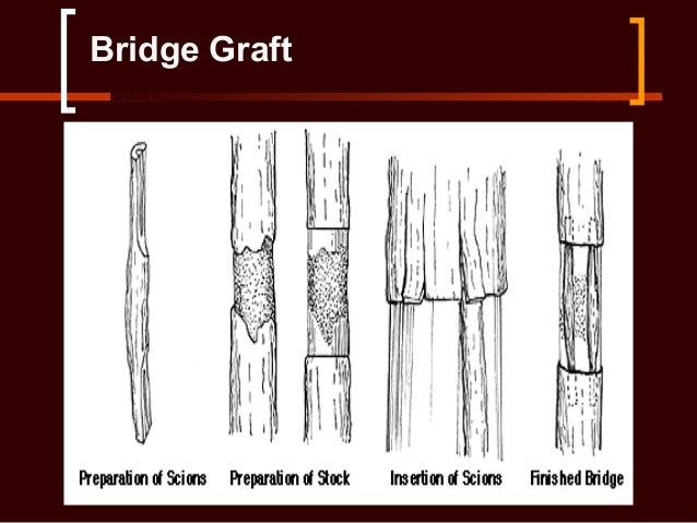 Image result for bridge grafting