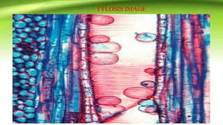 TYLOSIS IMAGE
 