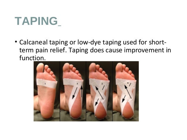 taping for calcaneal spur