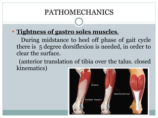 Plantar fasciitis slideshare clearance