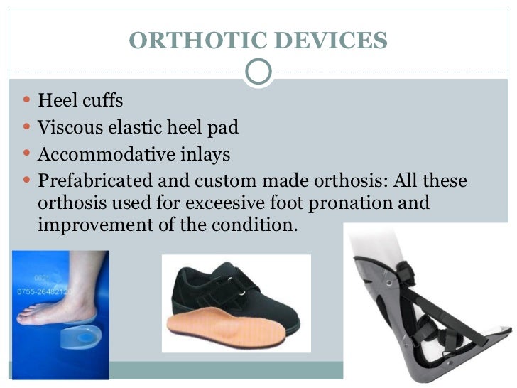 orthotic devices for plantar fasciitis