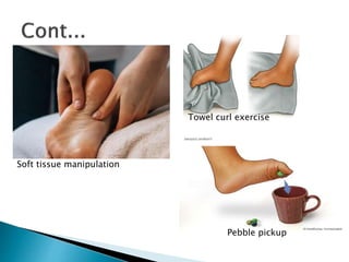 Pebbles Exercise PLANTAR FASCIITIS .pptx. This ppt is based on sports condition plantar ...
