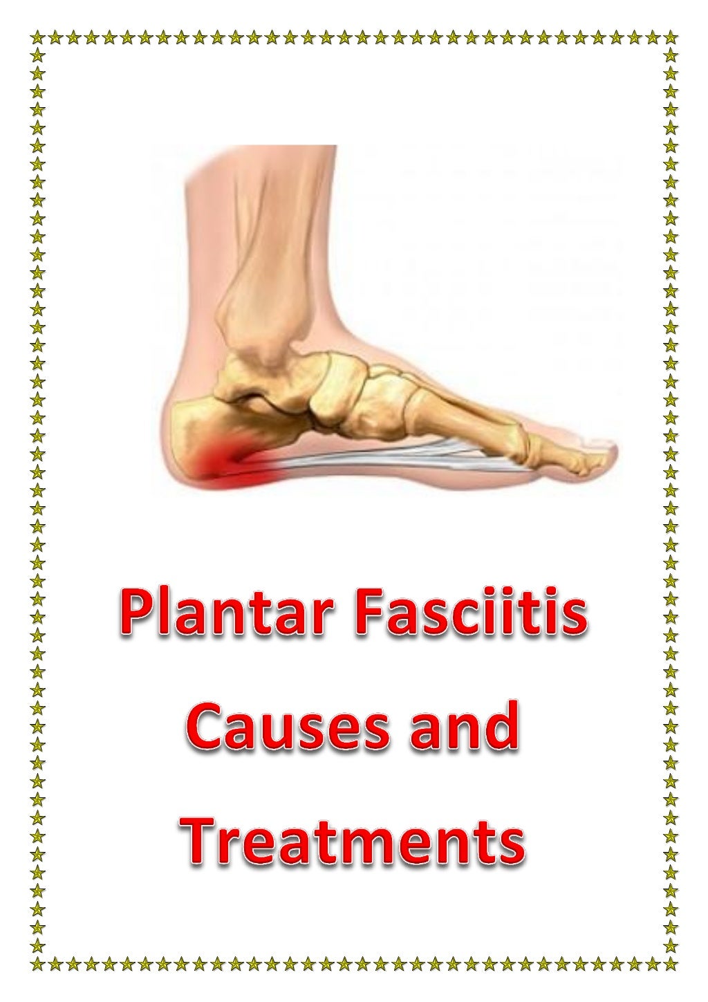 Plantar fasciitis causes and treatments